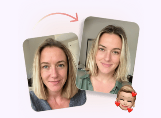 Antes y después de rejuvenecimiento facial